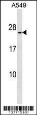 Anti-METTL7B Rabbit Polyclonal Antibody (AP (Alkaline Phosphatase))