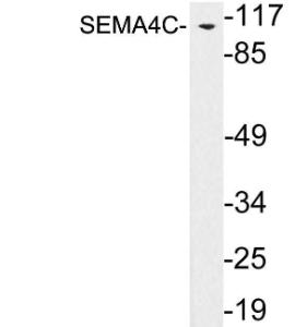 Western blot analysis of lysates from SW13 cells using Anti-SEMA4C Antibody