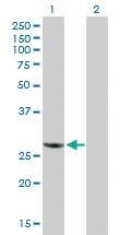 Anti-RBCK1 Mouse Polyclonal Antibody