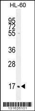 Anti-C1QC Rabbit Polyclonal Antibody (HRP (Horseradish Peroxidase))