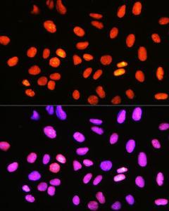 Immunofluorescence analysis of U-2 OS cells using Anti-Topoisomerase I Antibody [ARC0708] (A307759) at a dilution of 1:100 (40X lens). DAPI was used to stain the cell nuclei (blue)