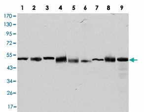 Anti-CCT2 Mouse Monoclonal Antibody [clone: 5B5C4]