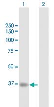 Anti-RBCK1 Rabbit Polyclonal Antibody