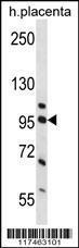 Anti-NCL Rabbit Polyclonal Antibody