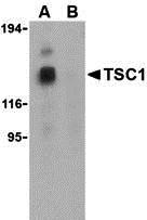 Western blot analysis of TSC1 in EL4 cell lysate with TSC1 antibody at 1 &#956;g/mL in the (A) absence and (B) presence of blocking peptide (3505P).