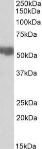 Anti-Aldh3a2 Antibody (A82962) (0.03 µg/ml) staining of Rat Liver lysate (35 µg protein in RIPA buffer). Primary incubation was 1 hour. Detected by chemiluminescence