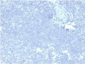 Negative Tissue Control: Immunohistochemical analysis of formalin-fixed, paraffin-embedded human tonsil using Anti-Mucin 5AC Antibody [MUC5AC/7068R] at 2 µg/ml in PBS for 30 minutes at room temperature