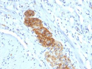 Immunohistochemical analysis of formalin-fixed, paraffin-embedded human colon using Anti-NCAM1 Antibody [NCAM1/784]