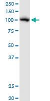 Anti-AARS Mouse Polyclonal Antibody