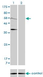 Anti-MDM2 Mouse Monoclonal Antibody [clone: 1A7]