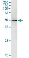 Anti-WAPAL Mouse Monoclonal Antibody