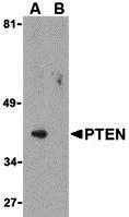 Western blot analysis of PTEN in PC-3 cell lysate with PTEN antibody at 1 &#956;g/mL in either the (A) absence or (B) presence of blocking peptide (3515P).