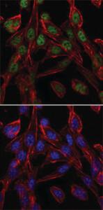 Anti-CCT2 Mouse Monoclonal Antibody [clone: 5B5C4]