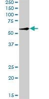 Anti-RBCK1 Rabbit Polyclonal Antibody