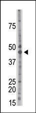 Anti-CSNK2A1 Rabbit Polyclonal Antibody (PE (Phycoerythrin))