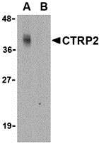 Western blot analysis of CTRP2 in Caco-2 cell lysate with CTRP2 antibody at 1 &#956;g/mL in either the (A) absence or (B) presence of blocking peptide (3561P).