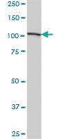 Anti-AARS Mouse Polyclonal Antibody