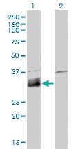 Anti-DNASE1L1 Mouse Monoclonal Antibody [clone: 4E8]