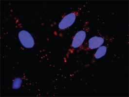 Anti-MDM2 Mouse Monoclonal Antibody [clone: 1A7]