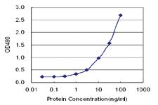 Anti-LRG1 Antibody Pair