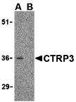 Western blot analysis of CTRP3 in mouse heart cell lysate with CTRP3 antibody at 1 &#956;g/mL in the (A) absence and (B) presence of blocking peptide (3565P).