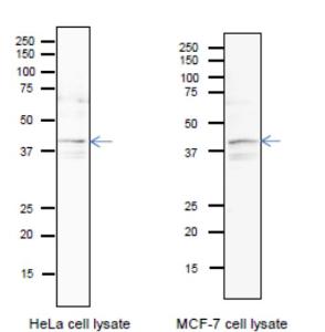 Anti-PURA Antibody