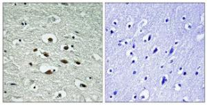 Immunohistochemical analysis of paraffin-embedded human brain using Anti-Chk1 (phospho Ser296) Antibody. The right hand panel represents a negative control, where the antibody was pre-incubated with the immunising peptide