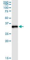 Anti-RBCK1 Rabbit Polyclonal Antibody