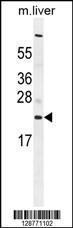 Anti-C1QL3 Rabbit Polyclonal Antibody (AP (Alkaline Phosphatase))