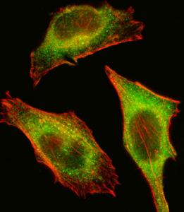 Anti-TEC Rabbit Polyclonal Antibody (HRP (Horseradish Peroxidase))