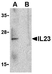 Western blot analysis of IL-23 in Raji lysate with IL-23 antibody at 1 &#956;g/mL in the (A) absence and (B) presence of blocking peptide (3793P).