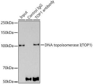 Immunoprecipitation analysis of 300 µg extracts of MCF7 cells using 3 µg of Anti-Topoisomerase I Antibody [ARC0708] (A307759). This Western blot was performed on the immunoprecipitate using Anti-Topoisomerase I Antibody [ARC0708] (A307759) at a dilution of 1:1000