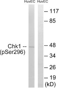 Western blot analysis of lysates from HUVEC cells treated with UV 15' using Anti-Chk1 (phospho Ser296) Antibody. The right hand lane represents a negative control, where the antibody is blocked by the immunising peptide