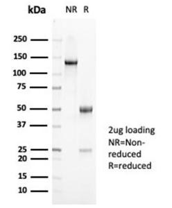 SDS-PAGE analysis of Anti-Mucin 5AC Antibody [MUC5AC/7068R] under non-reduced and reduced conditions; showing intact IgG and intact heavy and light chains, respectively. SDS-PAGE analysis confirms the integrity and purity of the antibody