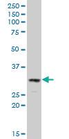 Anti-DNASE2 Mouse Polyclonal Antibody