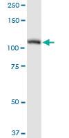 Anti-AARS Rabbit Polyclonal Antibody