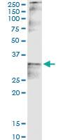 Anti-CCND2 Polyclonal Antibody Pair