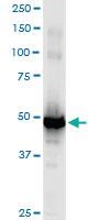 Anti-WAPAL Polyclonal Antibody Pair