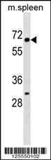 Anti-KLH22 Rabbit Polyclonal Antibody