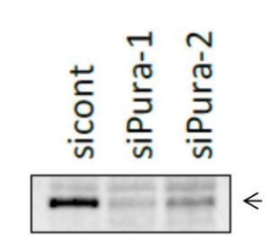 Anti-PURA Antibody