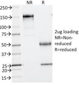 SDS-PAGE analysis of Anti-Phosphotyrosine Antibody [PY793] under non-reduced and reduced conditions; showing intact IgG and intact heavy and light chains, respectively. SDS-PAGE analysis confirms the integrity and purity of the antibody