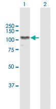 Anti-AARS Rabbit Polyclonal Antibody