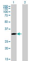 Anti-MRPS18B Mouse Polyclonal Antibody