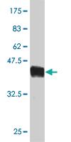 Anti-TOMM20 Mouse Monoclonal Antibody [clone: 4F3]