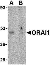 Western blot analysis of ORAI1 in human ovary tissue lysate with ORAI1 antibody at 1 &#956;g/mL in the (A) absence or (B) presence of blocking peptide.