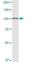 Anti-AARS Rabbit Polyclonal Antibody