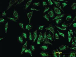 Anti-TOMM20 Mouse Monoclonal Antibody [clone: 4F3]