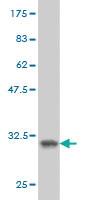 Anti-SH3GL2 Mouse Monoclonal Antibody [clone: 5A6]