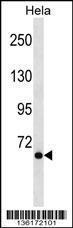 Anti-NCOA4 Rabbit Polyclonal Antibody (AP (Alkaline Phosphatase))