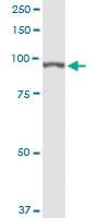 Anti-AARS Rabbit Polyclonal Antibody